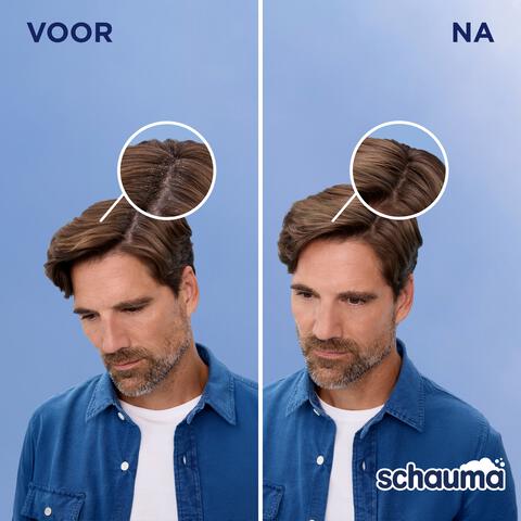 Schauma Shampoo Anti-roos 400 ML