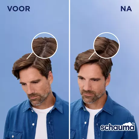 Schauma Shampoo Anti-roos 400 ML