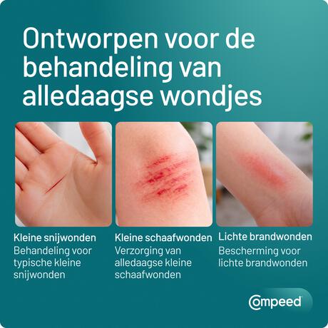 Compeed smartskin Multiwond medium 10 st
