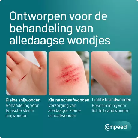 Compeed smartskin Multiwond medium 10 st