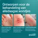 Compeed smartskin Multiwond medium 10 st
