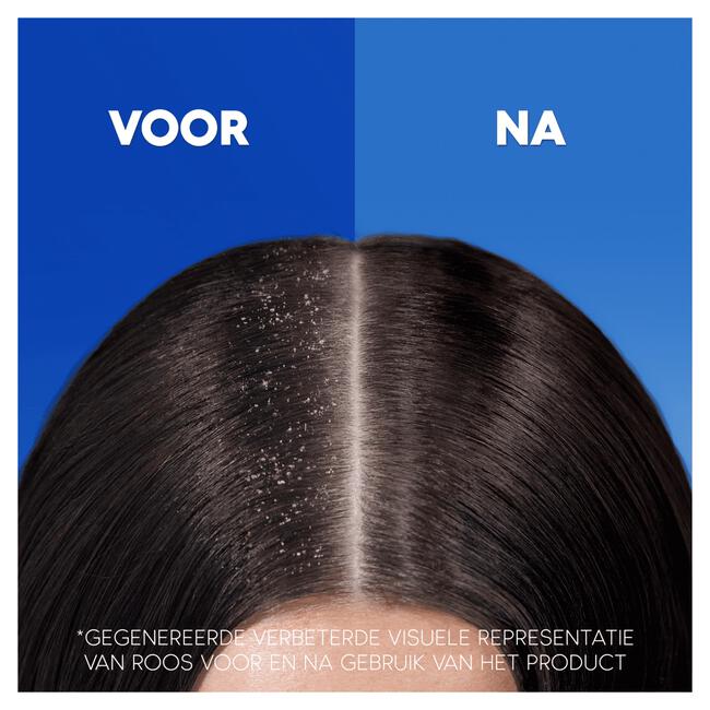 Head & Shoulders Sensitive Anti-roos Shampoo 285 ML