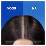 Head & Shoulders Sensitive Anti-roos Shampoo 285 ML