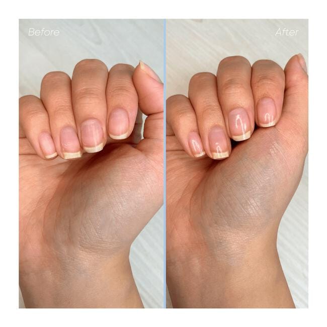 Herome Nail Essentials Set Droge en Geribbelde Nagels