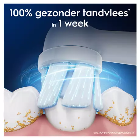 Oral-B iO Gentle Care Opzetborstels Wit 4 Stuks