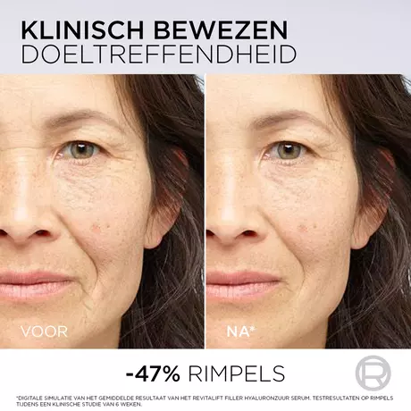 L'Oréal Paris Revitalift Filler Anti-Rimpel Volumegevend Serum met PDRN 30 ML