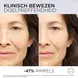 L'Oréal Paris Revitalift Filler Anti-Rimpel Volumegevend Serum met PDRN 30 ML
