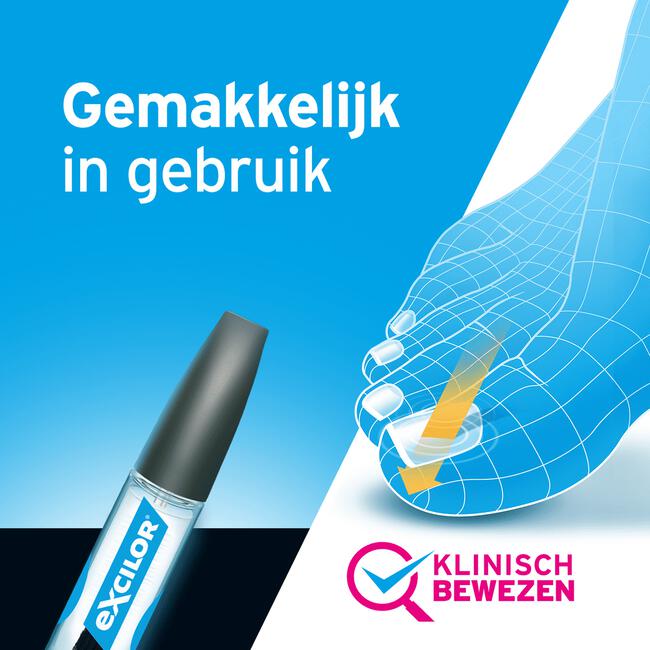 Excilor Kalknagel Behandeling 3,3 ML