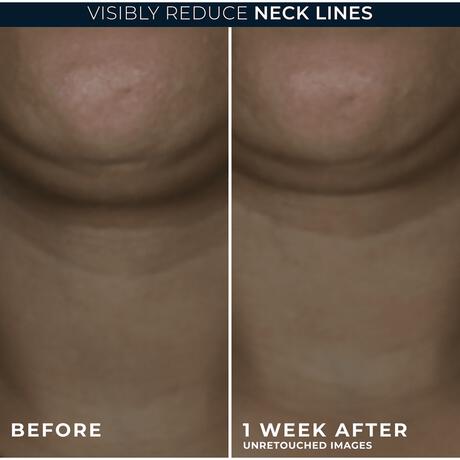 RoC Derm Correxion Contour Cream 50 ML