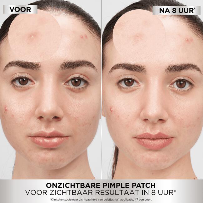 Garnier Pure Active Pimple Patch 22 stuks