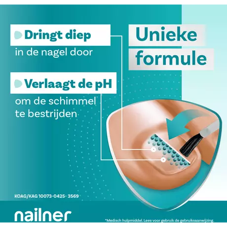 Nailner Kalknagelpen Multi-Action 2x4 ML