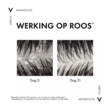 Vichy Dercos Anti-Roos Shampoo Droog Haar 390 ML