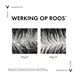 Vichy Dercos Anti-Roos Shampoo Droog Haar 390 ML