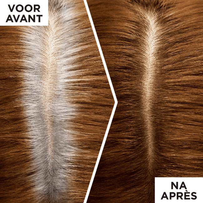 L'Oréal Paris Magic Retouch Camouflerende Uitgroeispray Goud Middenbruin 75 ML