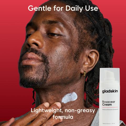 Gladskin Rosacear Cream 30 ML