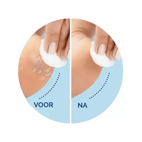 Scholl Velvet Smooth Voetvijl Navulling Extra Grof 2 stuks