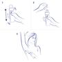 Dove Compressed Invisible Dry Anti-transpirant Deodorant Spray 75 ML
