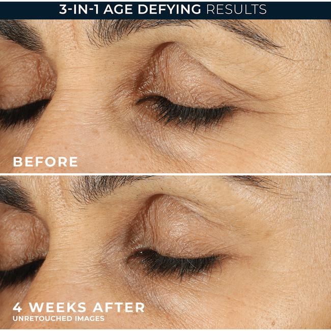 Roc Retinol Correxion Line Smoothing Eye Cream 15 ML