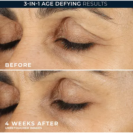 RoC Retinol Correxion Line Smoothing Eye Cream 15 ML