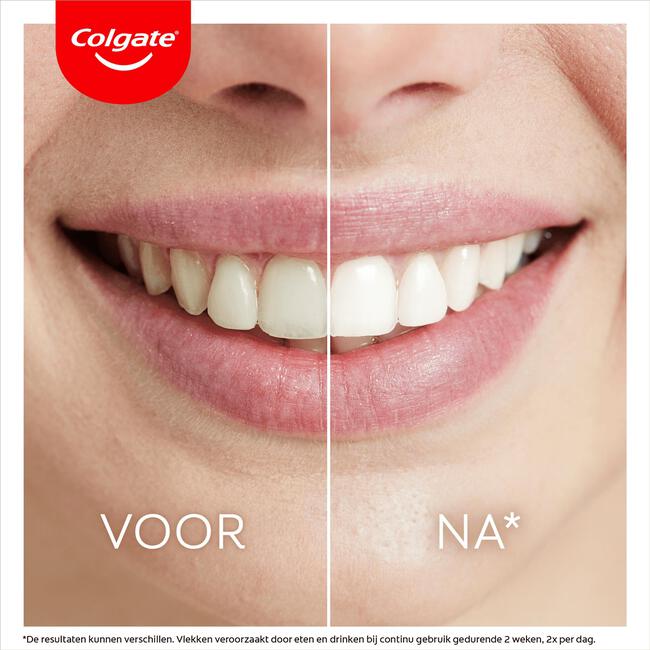Colgate Max White Ulitmate Led Whitening Kit + Pen