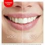 Colgate Max White Ulitmate Led Whitening Kit + Pen