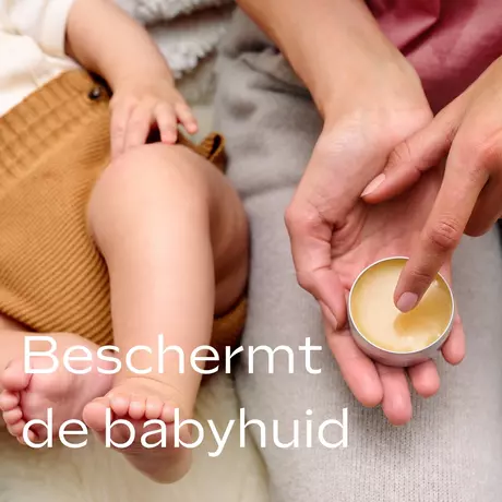 WELEDA Baby Calendula Alles-In-Één Balsem 25 gram