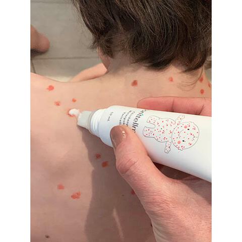 donttellmum Waterpokken Behandeling 50 ML