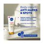 NIVEA Luminous 630 Anti-Striae Bodycrème 200 ML