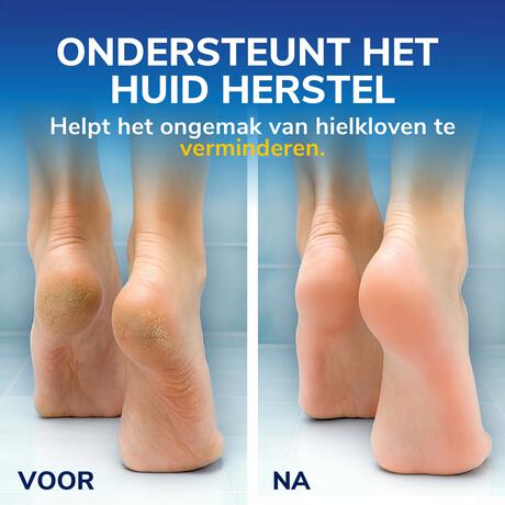 Dr.Scholl's tegen Hielkloven Voetcrème met 25% Ureum 60 ML