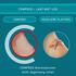 Compeed Blarenpleister Extreem 6 stuks