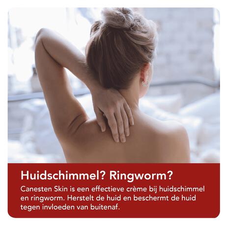 Canesten SKIN huidschimmel creme 30 GR