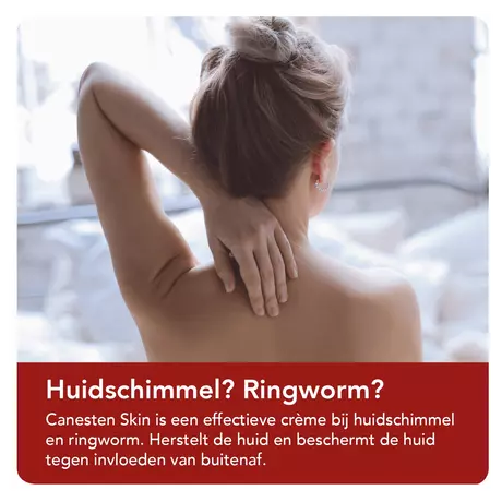Canesten SKIN Huidschimmel Creme 30 gram