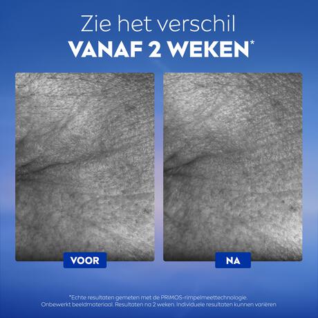 NIVEA Cellular Epigenetics Cryo Anti-Age Oogserum 15 ML