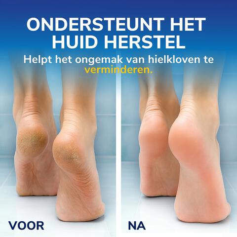 Dr.Scholl's Active Repair K+ Klovenzalf 60 ML