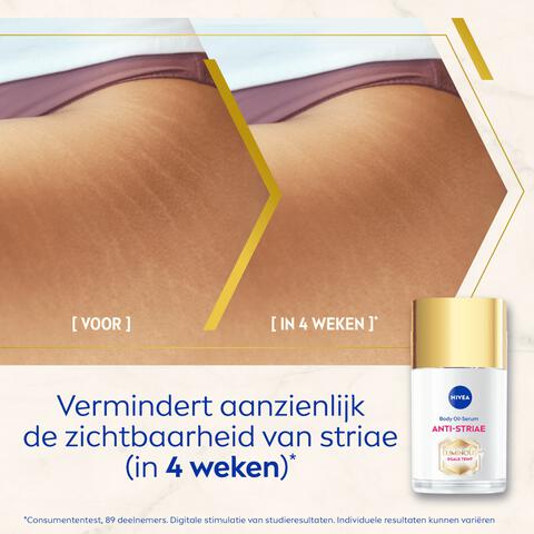 NIVEA Luminous630 Anti-Striae Lichaamsolie-serum 100 ML