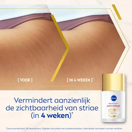 NIVEA Luminous630 Anti-Striae Lichaamsolie-Serum 100 ML