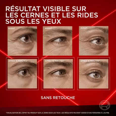 L'Oréal Paris Revitalift Laser Instant Eye Bag Corrector 15 ML