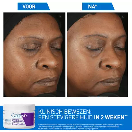CeraVe Skin Renewing Peptide Creme 48 gram