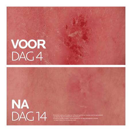 La Roche-Posay Cicaplast Balsem B5 Gevoelige Huid 40 ML