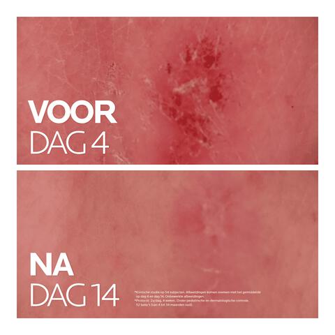 La Roche-Posay Cicaplast Balsem B5 Gevoelige Huid 40 ML