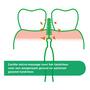 GUM Trav-Ler Groen 1,1 MM