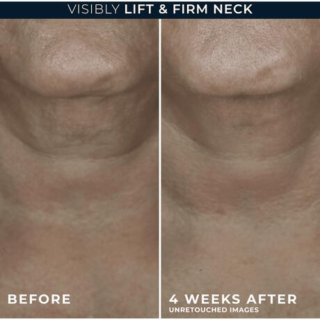 RoC Derm Correxion Contour Cream 50 ML