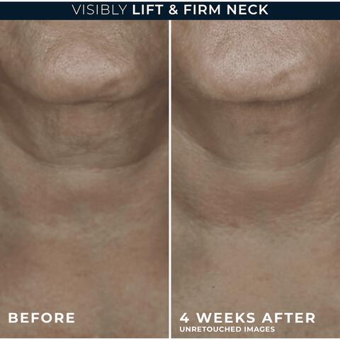 RoC Derm Correxion Contour Cream 50 ML