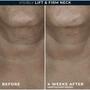 RoC Derm Correxion Contour Cream 50 ML