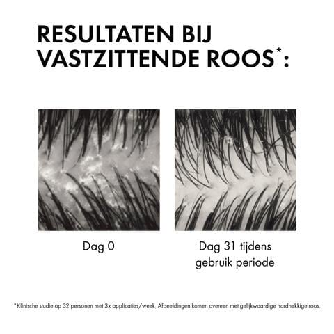 Vichy Dercos Anti-Roos DS Shampoo NH/VH Navulling 390 ML