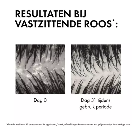 Vichy Dercos Anti-Roos DS Shampoo NH/VH Navulling 390 ML