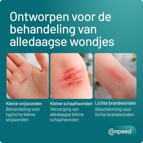 Compeed Smartskin Multiwond Mixpack 10 stuks