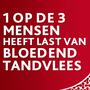 Parodontax Whitening Dagelijkse Tandpasta Tegen Bloedend Tandvlees 75 ML