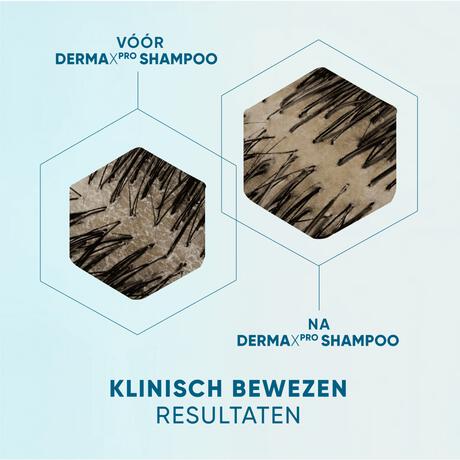 Head & Shoulders Derma X Pro Hydrateert Shampoo Anti-roos 250 ml