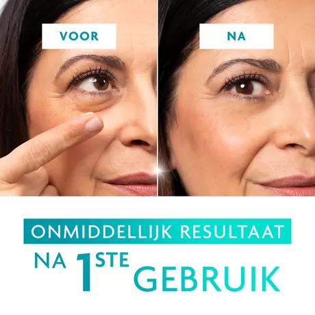 Remescar Wallen & Donkere Kringen Crème 8 ML